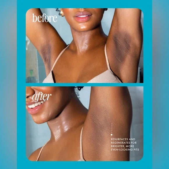 "Upgraded version"⚡️ 5-Second Post-Hair Removal Rescue: Bumps Fade, Skin Glows! Glass Smooth Oil.